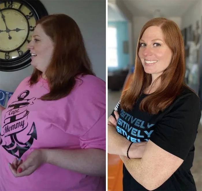 Vorher-Nachher Vergleich